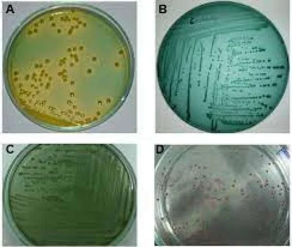 Bệnh do Vibrio spp: Nguyên nhân, triệu chứng và cách phòng tránh